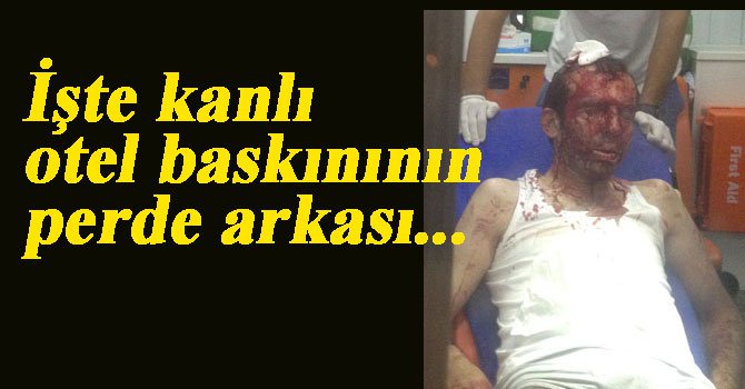 Kanlı baskından 