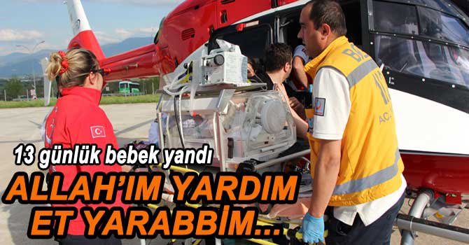 13 GÜNLÜK BEBEK YANDI