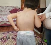 MİNİK BERKAY YAŞAM MÜCADELESİ VERİYOR