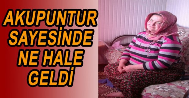 AKUPUNTUR SAYESİNDE 36 KİLO VERDİ