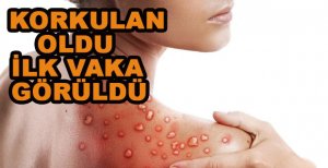 KORKULAN OLDU TÜRKİYE'YE SIÇRADI