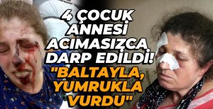 BOLU'DA 4 ÇOCUK ANNESİ ACIMASIZCA DARP EDİLDİ...